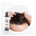 Nioxin System 2 Scalp & Hair Treatment bezoplachová starostlivosť pre jemné alebo rednúce vlasy