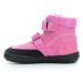 topánky Jonap Falco zima ružová vlna slim 25 EUR