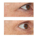 Perricone MD Essential Fx Acyl-Glutathione Eyelid Lift Serum liftingové očné sérum