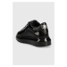 Kožené tenisky Karl Lagerfeld KL62539S KAPRI čierna farba