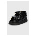 Sandále Kat Maconie Km - Rimini dámske, čierna farba, na platforme